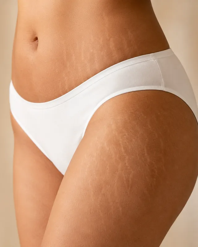 Close-up of stretch marks and changes in skin texture