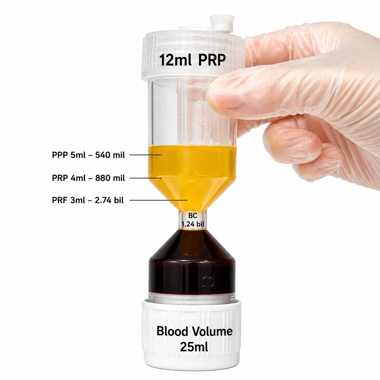 Labelled diagram of the WorldPRP&reg; 12ml hourglass tube showing PPP, PRP and PRF volumes separated from a 25ml blood draw