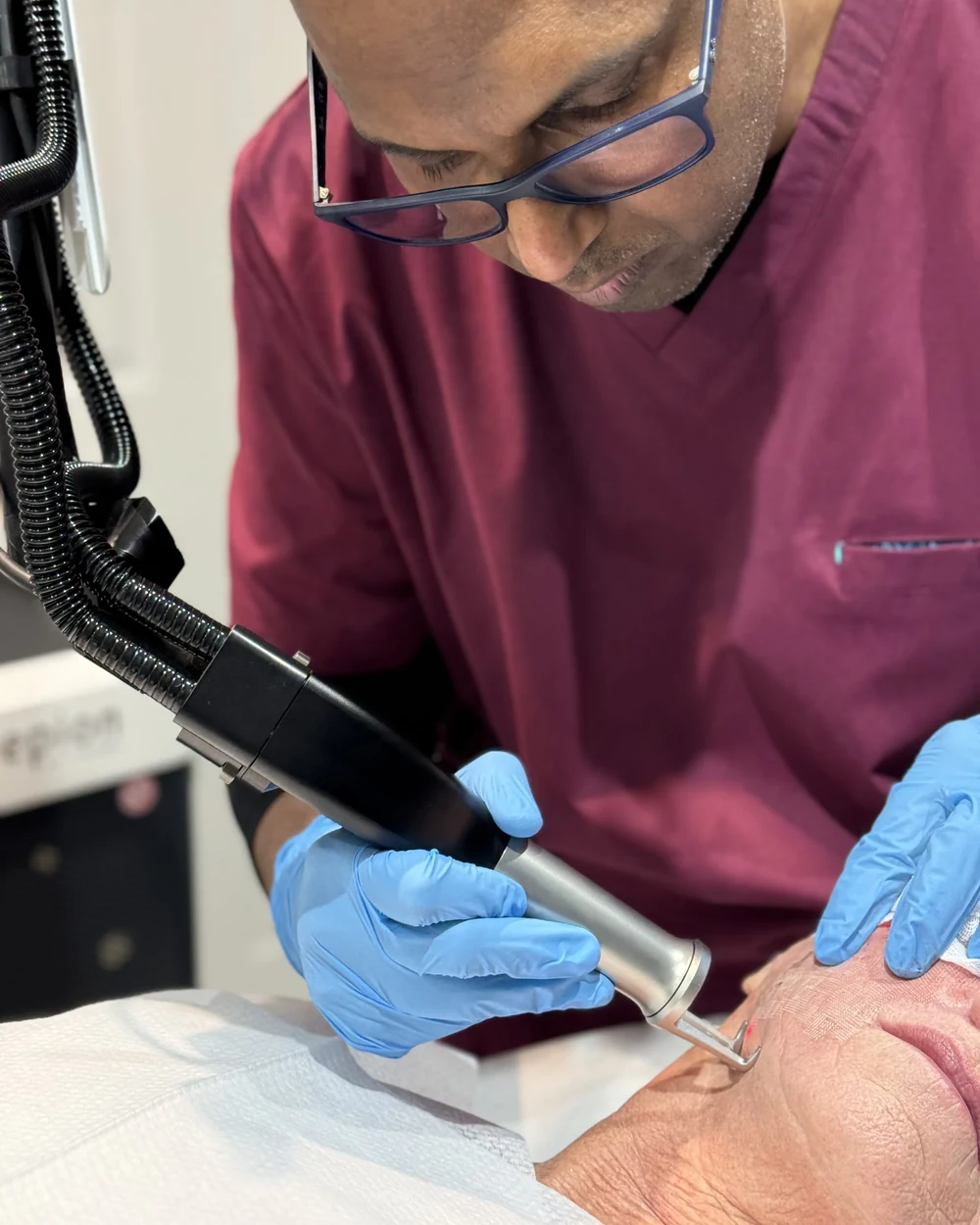 Dr Nick performing a doctor-led Cool Laser&trade; skin resurfacing treatment on a patient’s face at Rejuvena Clinic, Bedford