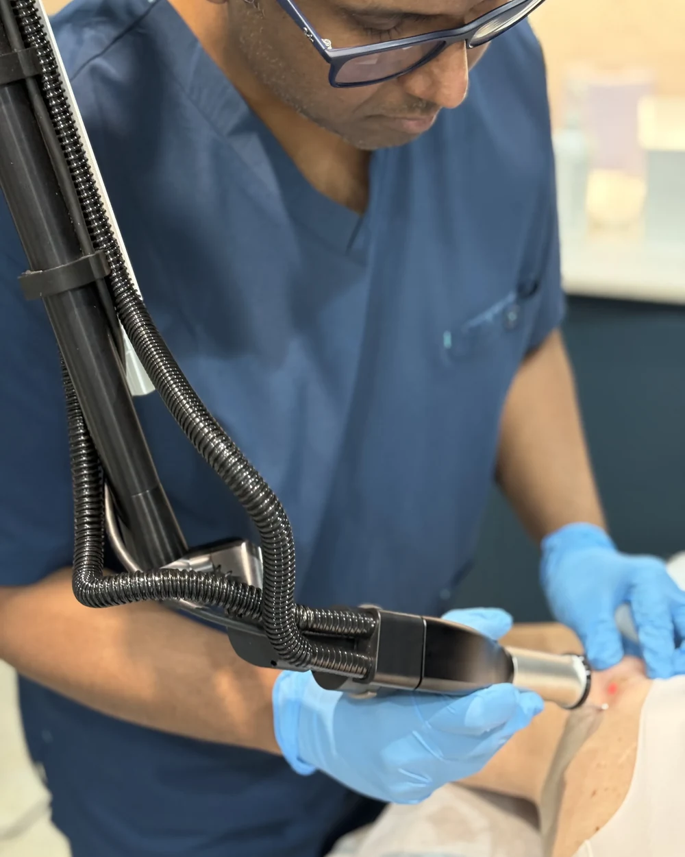 Dr Nick performing a doctor-led cryotherapy treatment to remove a benign skin lesion at Rejuvena Clinic, Bedford