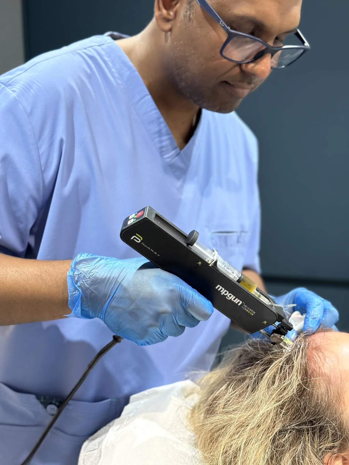 Dr Nick delivering a doctor-led PRP scalp treatment with the mpgun mesotherapy injector during hair loss treatment at Rejuvena, Bedford