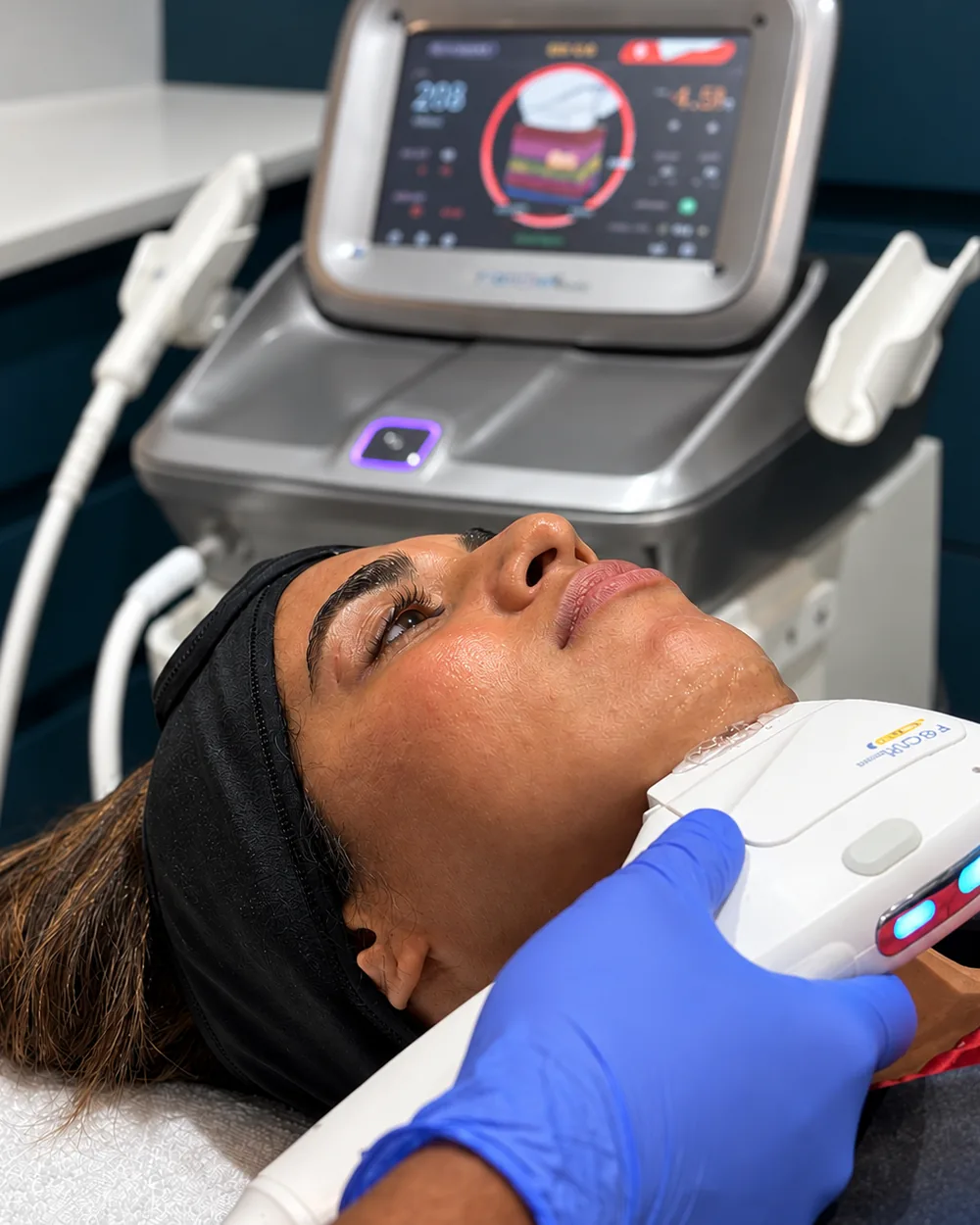 A clinician applying the Ultra Tight HIFU handpiece to a patient’s jawline, with the HIFU device behind, at Rejuvena Clinic, Bedford