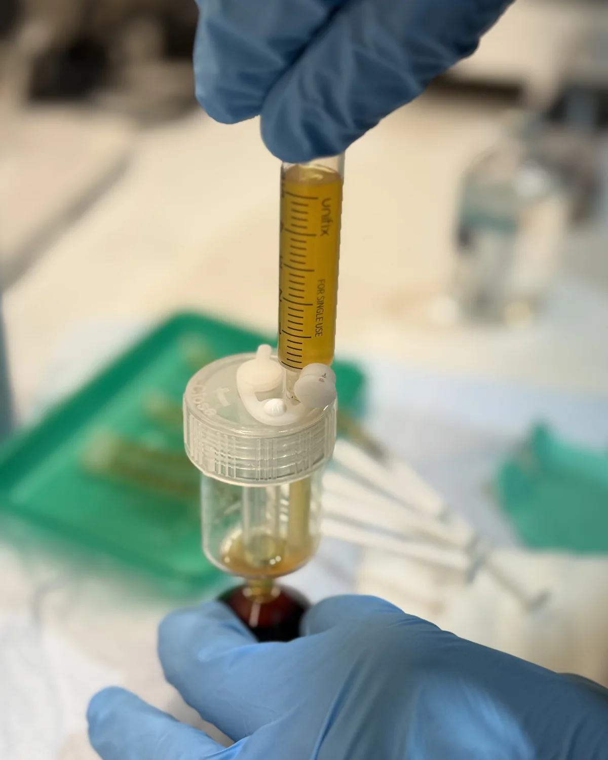 Golden platelet-rich plasma being drawn from a WorldPRP&trade; separator tube into a syringe before a PRP treatment at Rejuvena Clinic, Bedford
