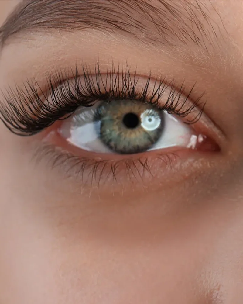 Dark circle treatment in Bedford
