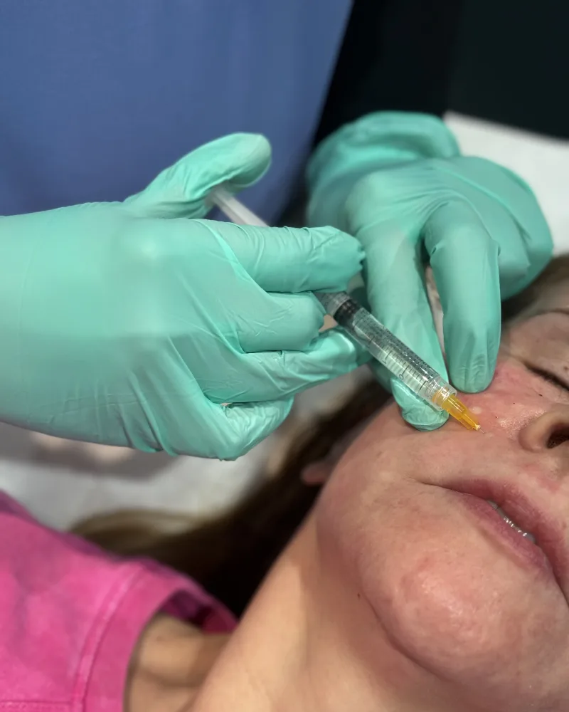 Under eye treatments in Bedford