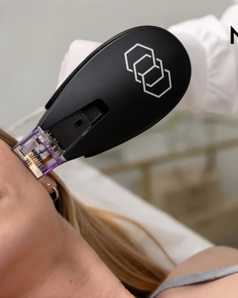 Morpheus8 Burst RF microneedling handpiece