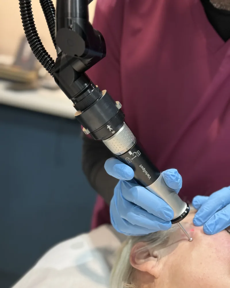 Skin tag removal in Bedford