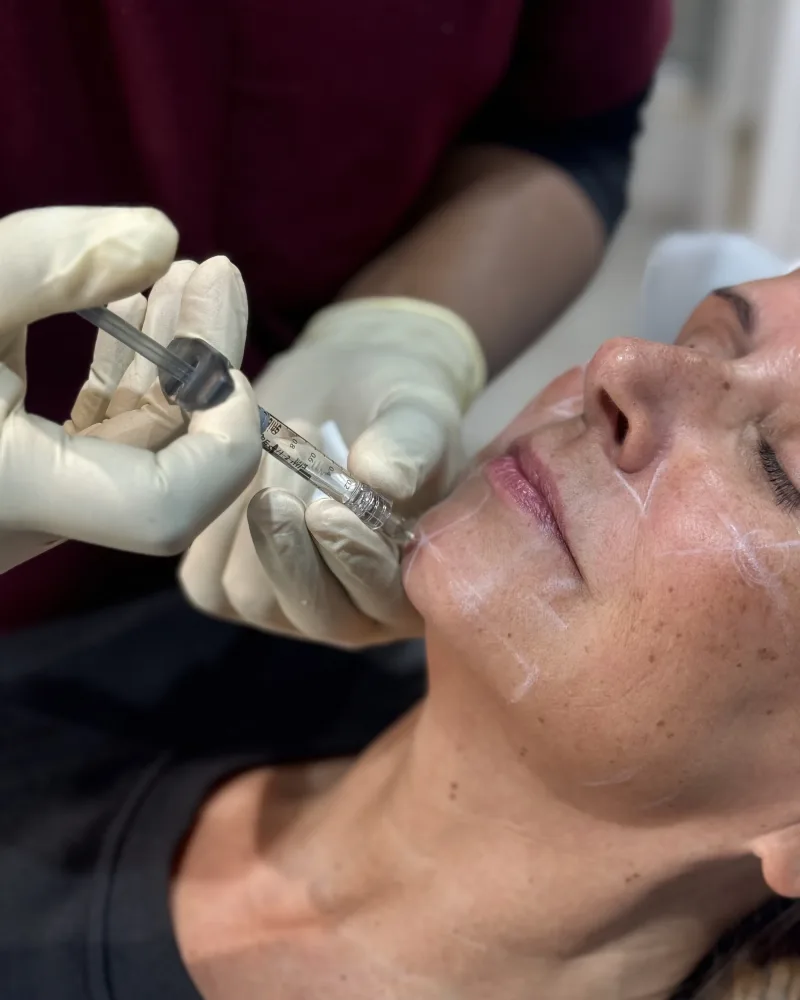 Doctor marking facial treatment areas before an injectable procedure at Rejuvena Clinic, Bedford