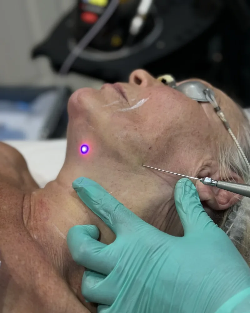Dr Nick assessing a patient for non-surgical EndoContour radiofrequency skin tightening at Rejuvena Clinic in Bedford
