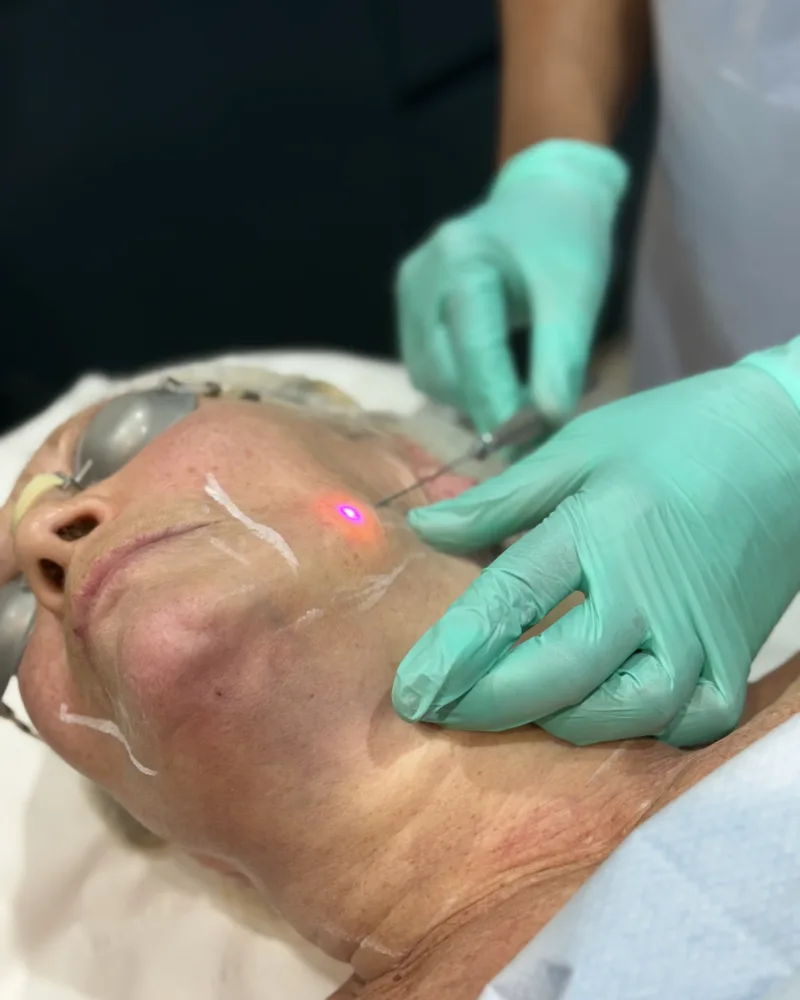 Non-Surgical Body Treatments in Bedford — Rejuvena, Bedford