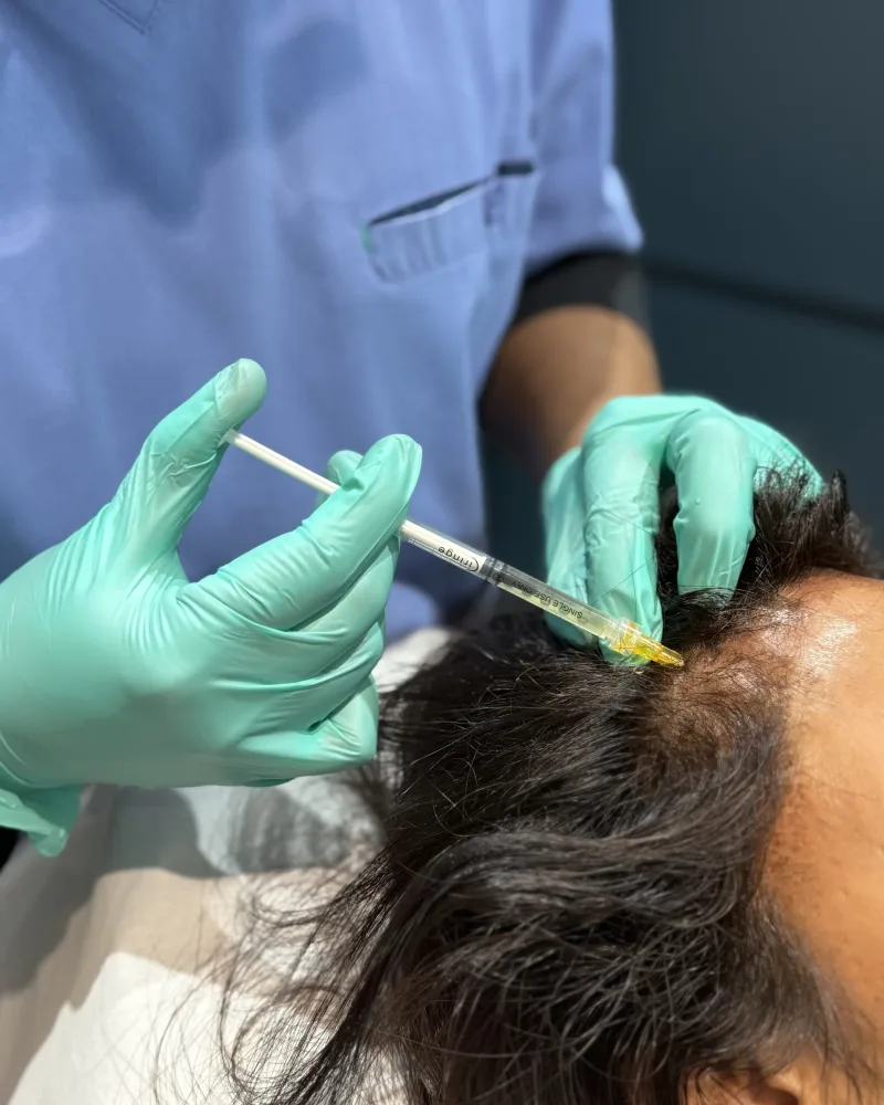 Hair Loss Treatments in Bedford — Rejuvena, Bedford