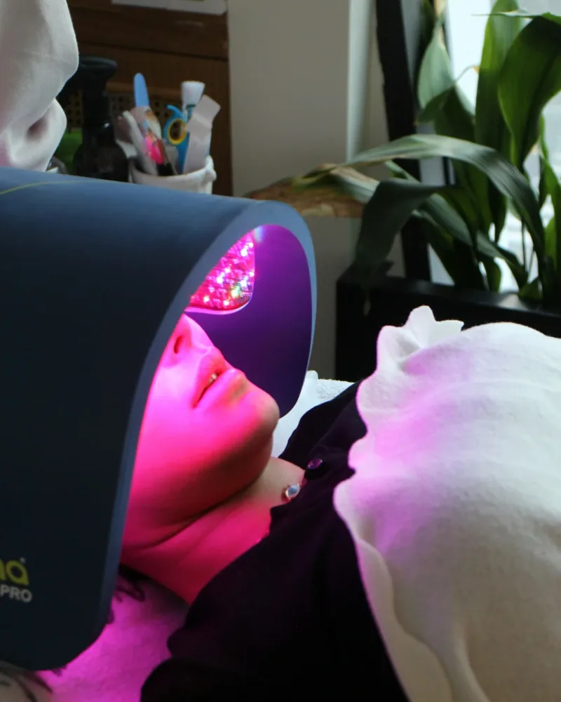 Dermalux LED phototherapy treatment at Rejuvena Bedford
