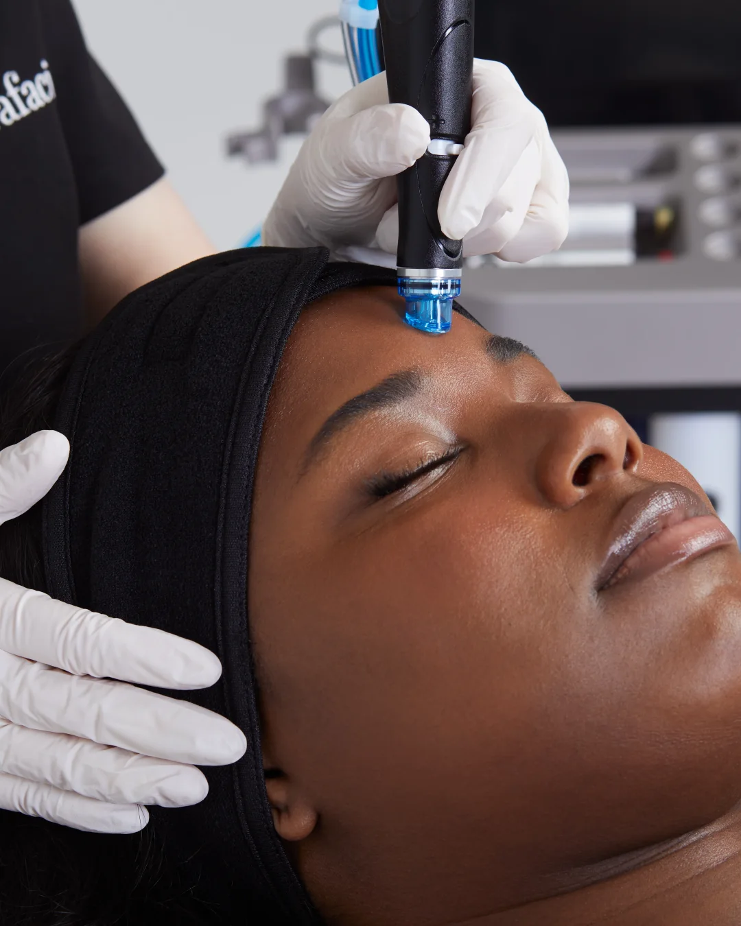 HydraFacial at Rejuvena Bedford