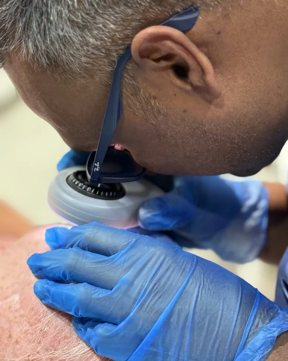 Dr Nick, GMC-registered Medical Director, examining a patient's mole with a dermatoscope during a skin assessment at the Rejuvena clinic in Bedford
