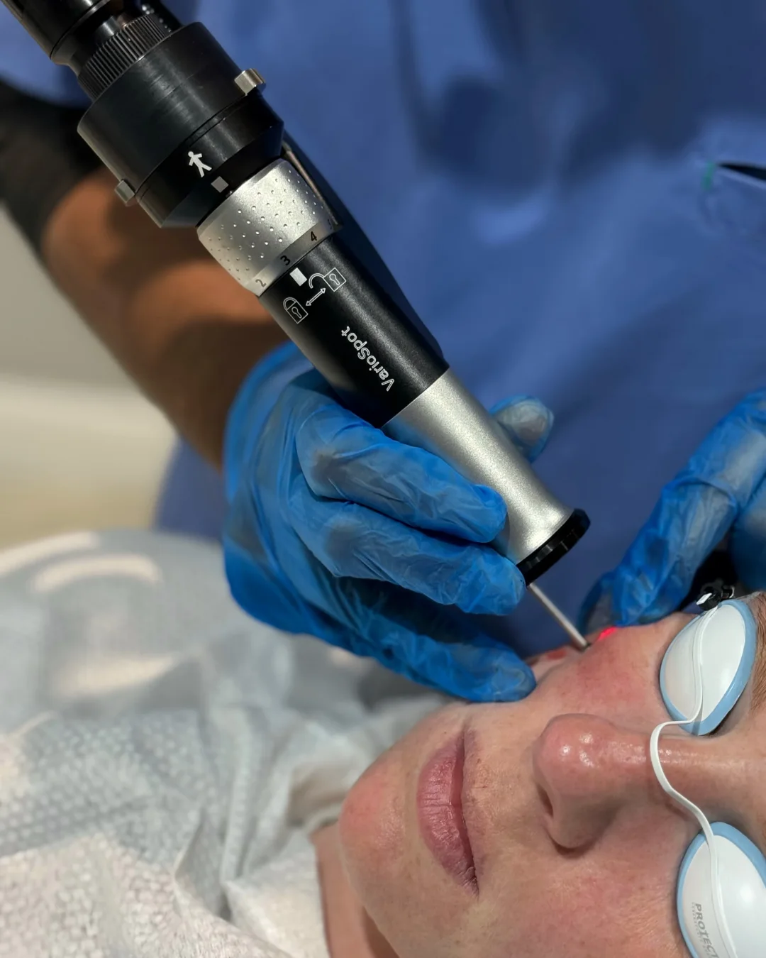 Laser Lesion Removal at Rejuvena Bedford