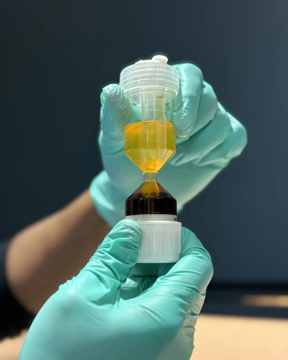 Clinician at Rejuvena Bedford preparing a patient's own blood sample for PRP and PRF hair restoration in a clean clinical treatment room