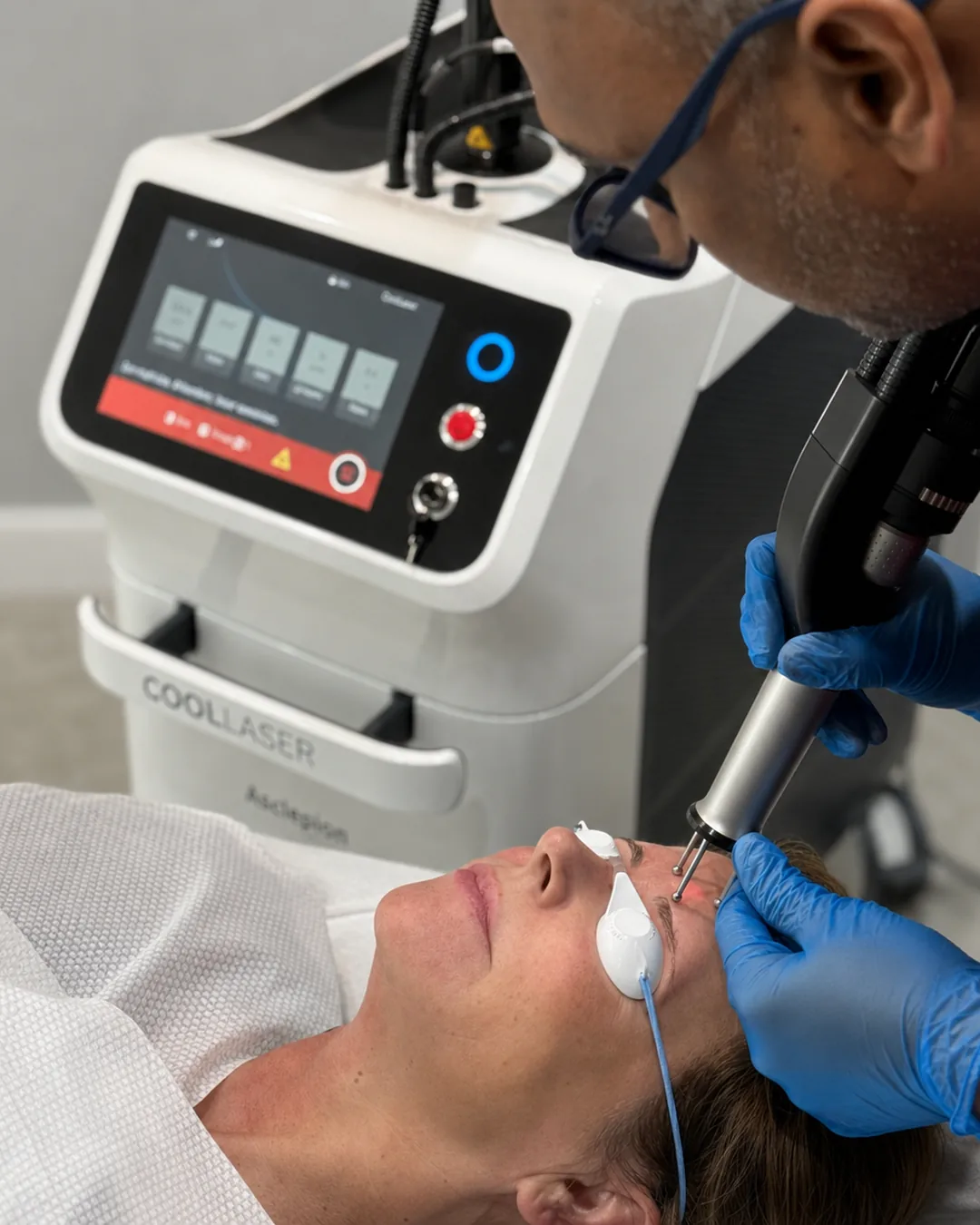Dr Nick performing Cool Laser resurfacing around the eye area with the Dermablate Er:YAG handpiece, patient wearing protective eye shields, at Rejuvena Clinic in Bedford