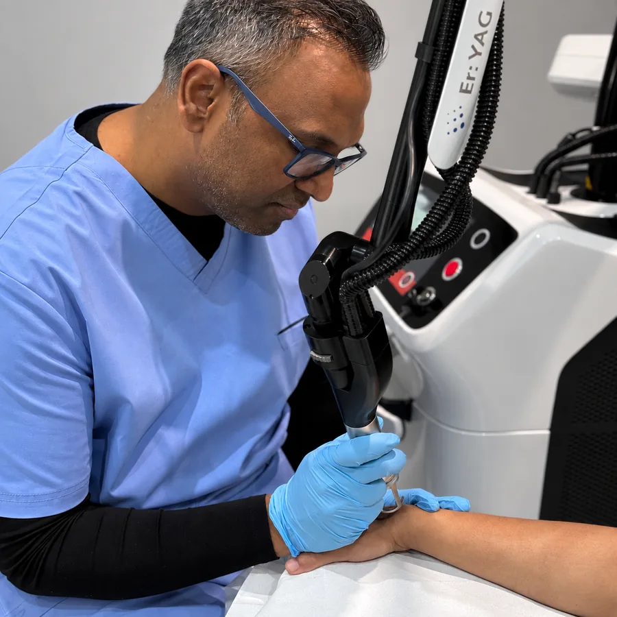 Dr Nick performing Cool Laser scar revision with the Dermablate Er:YAG handpiece at Rejuvena Clinic in Bedford