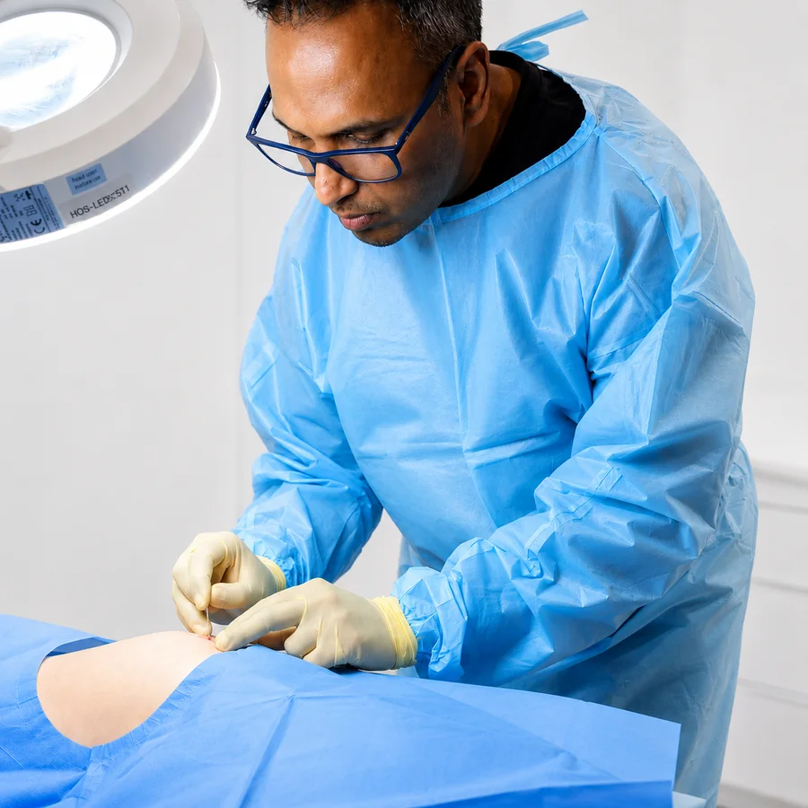 Dr Nick collecting a small amount of adipose tissue from a donor area during SEFFILLER nano fat transfer in Bedford