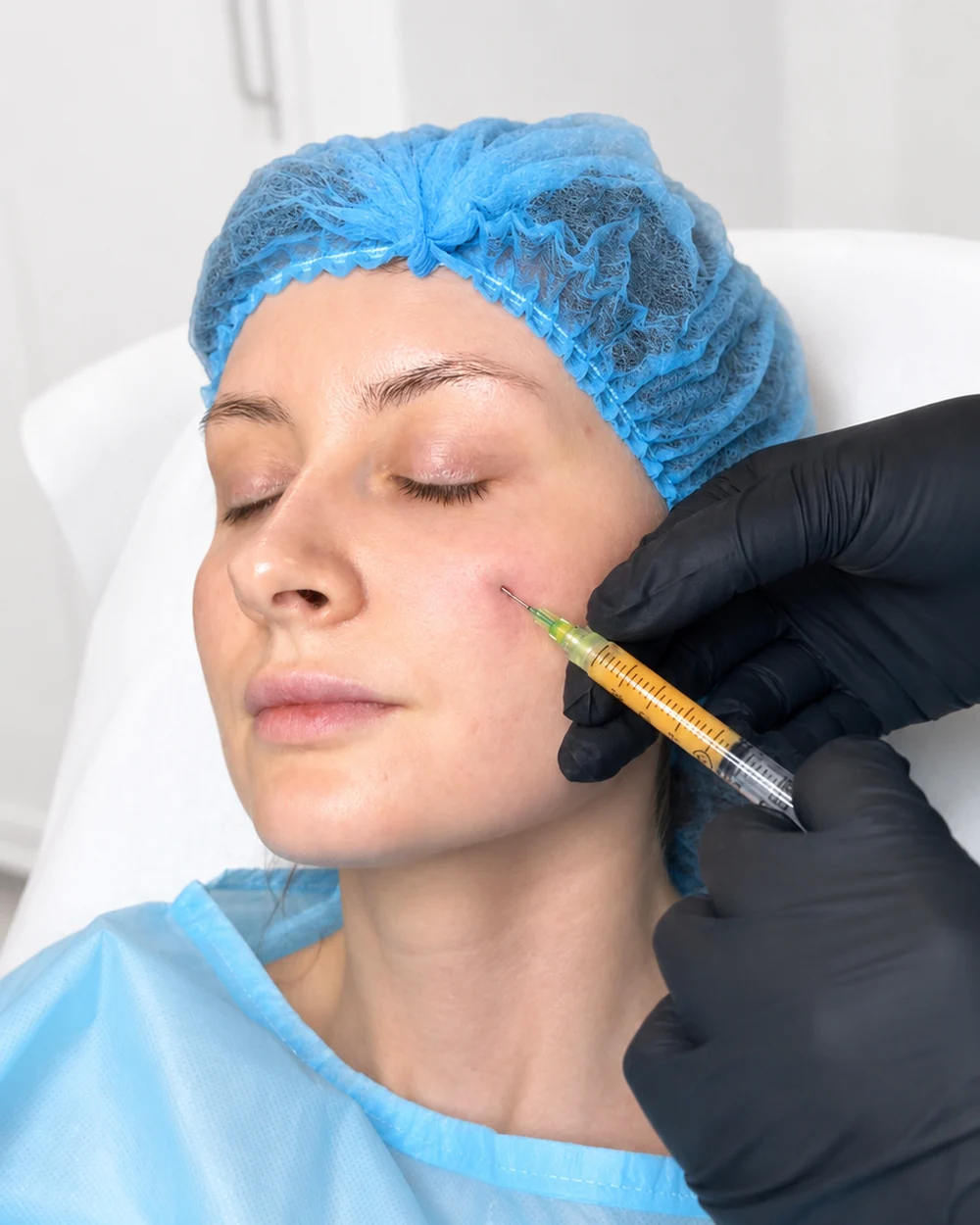 Nano fat transfer being performed on a patient at Rejuvena Clinic, Bedford