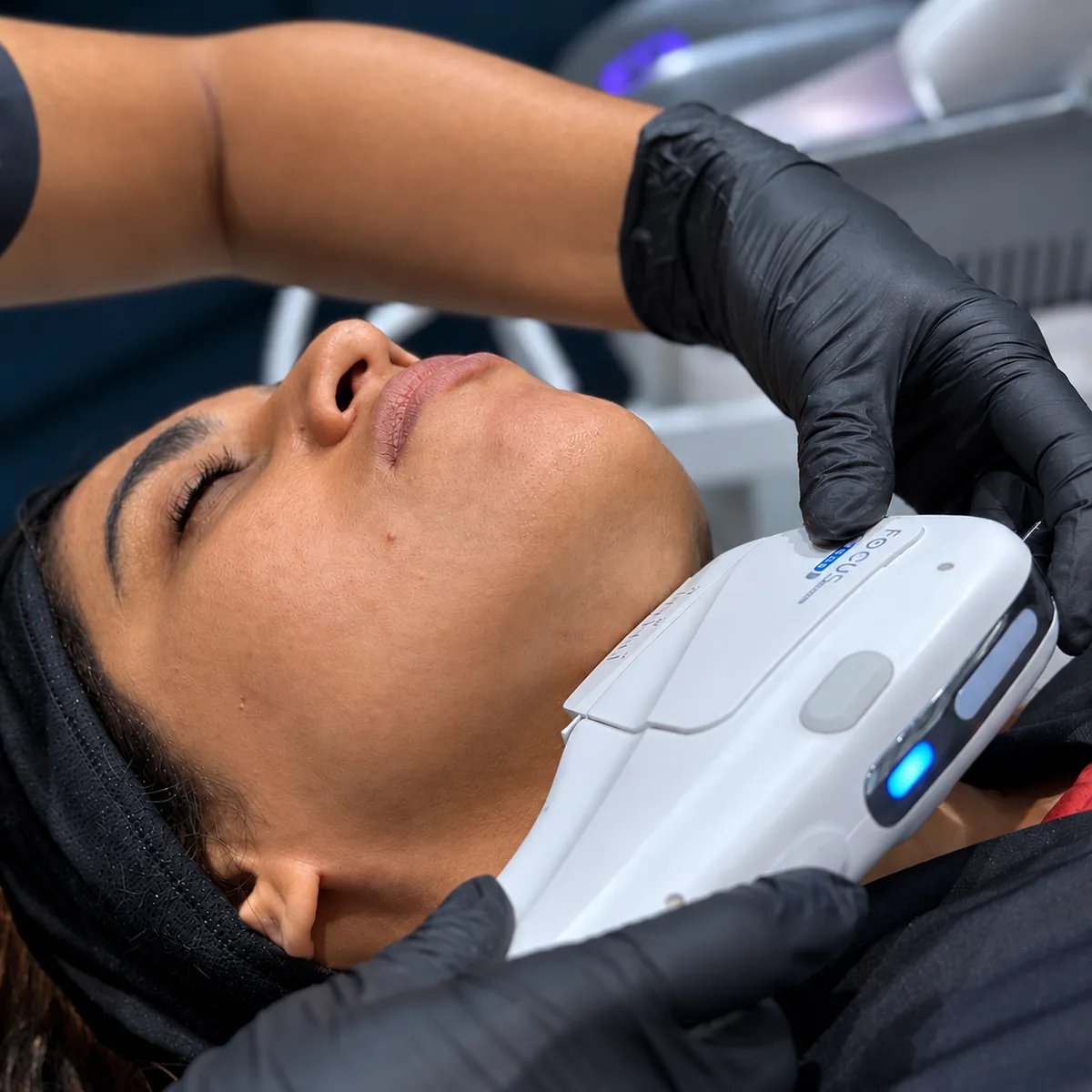 A clinician delivering HIFU with the Ultra Tight handpiece along a patient’s jawline at Rejuvena Clinic, Bedford