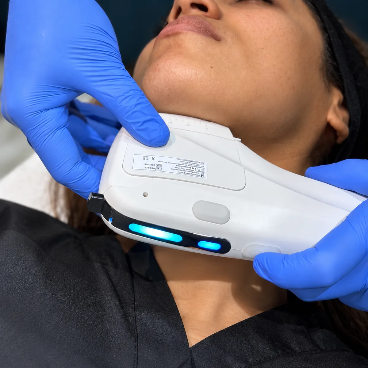 Close-up of the Ultra Tight HIFU handpiece being held against a patient’s neck and jawline at Rejuvena Clinic, Bedford