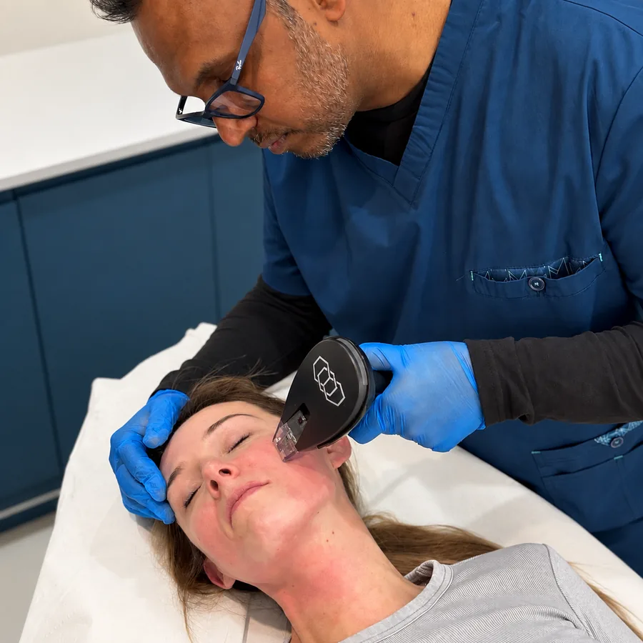 Dr Nick treating a patient’s forehead with the Morpheus8 Burst RF microneedling handpiece at Rejuvena Clinic in Bedford