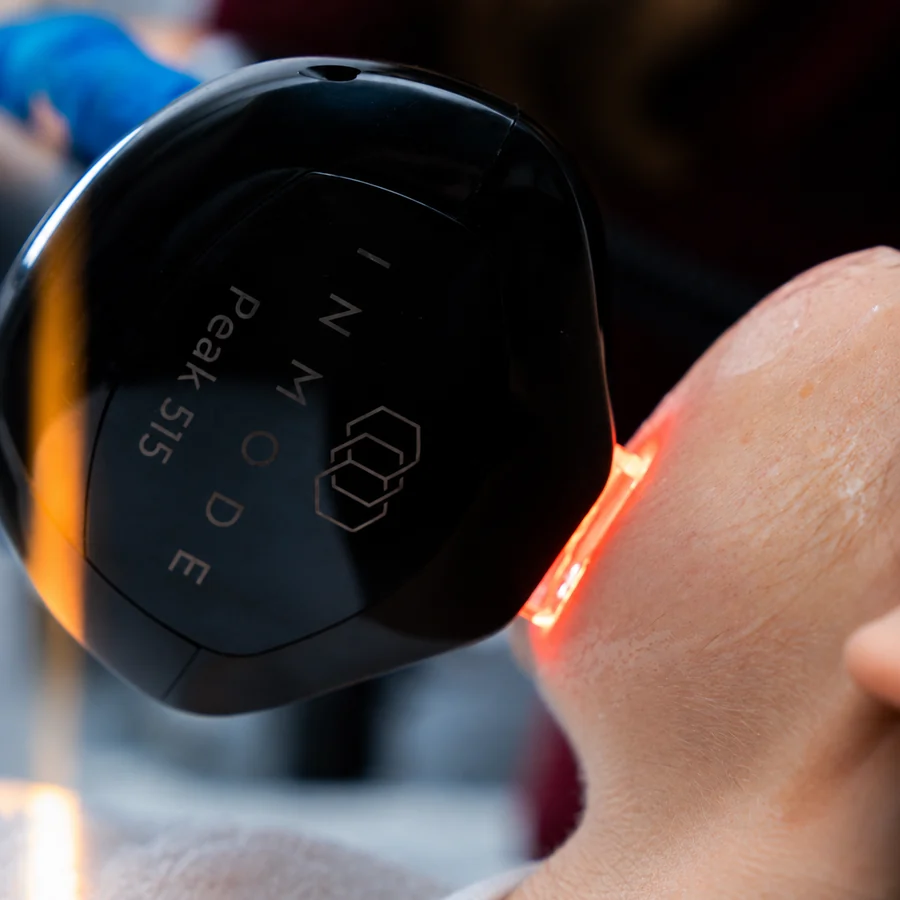 Close-up of the InMode Lumecca Peak handpiece delivering a pulse of light to the skin at Rejuvena Clinic, Bedford