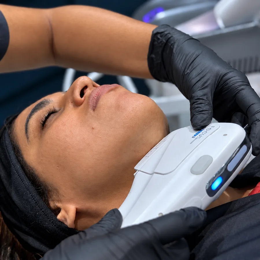 HIFU ultrasound lifting treatment being carried out along a patient’s jawline at Rejuvena Clinic in Bedford