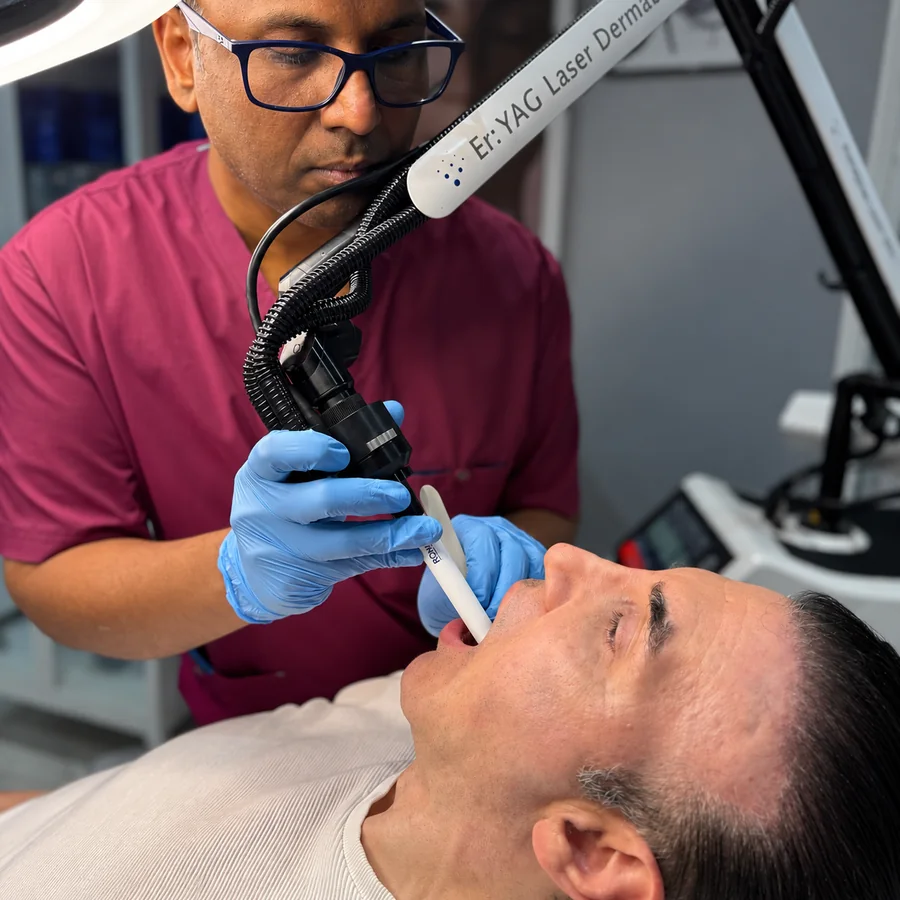 Dr Nick delivering Romeo anti-snoring laser treatment with the Er:YAG handpiece at Rejuvena Clinic in Bedford