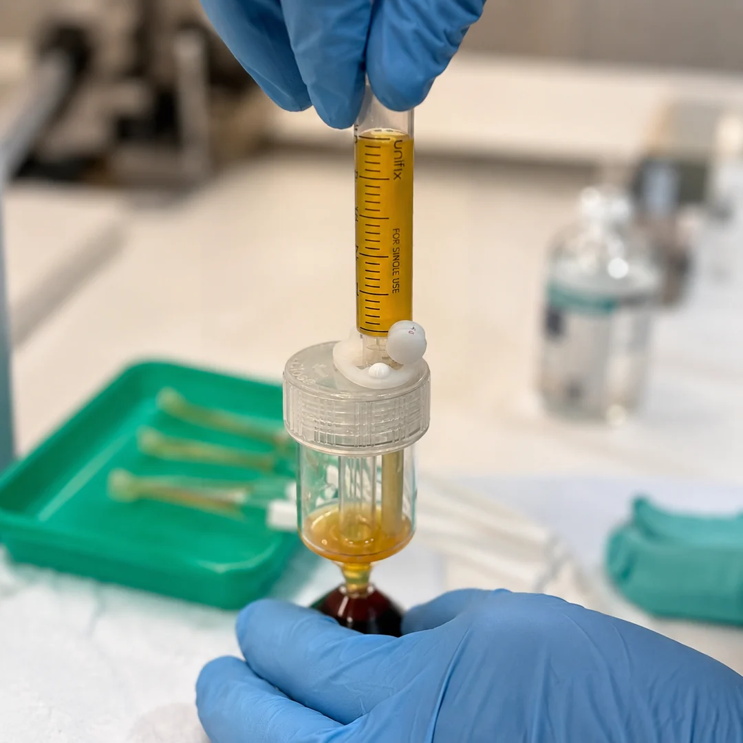 PRP being prepared in the WorldPRP separation tube by our doctor-led team at Rejuvena, Bedford