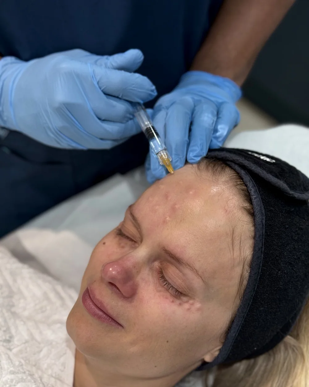 Dr Nick administering a doctor-led skin-booster treatment at Rejuvena Laser & Aesthetic Clinic, Bedford