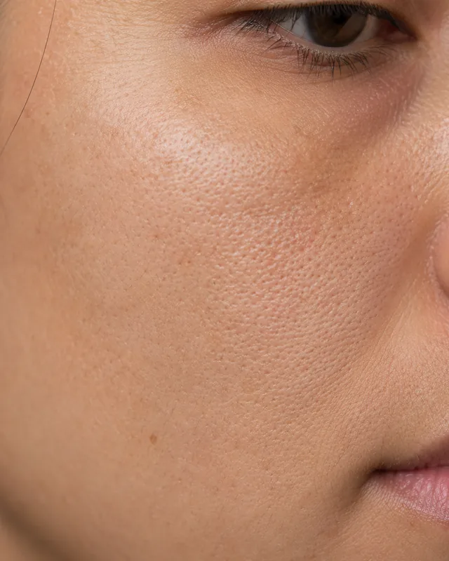 Natural image showing uneven texture & pores