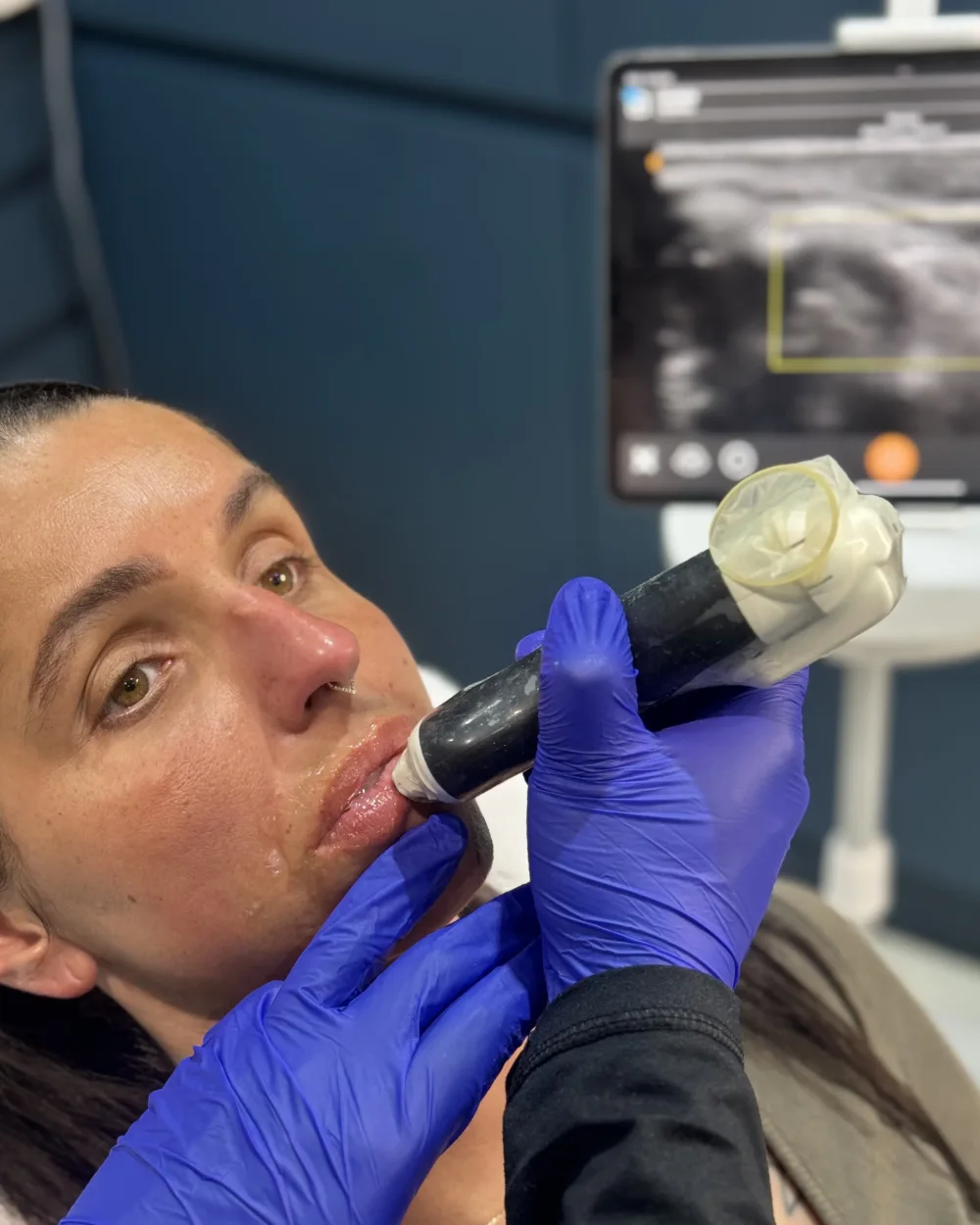 Clarius ultrasound probe in use during a doctor-led facial assessment at Rejuvena Clinic in Bedford