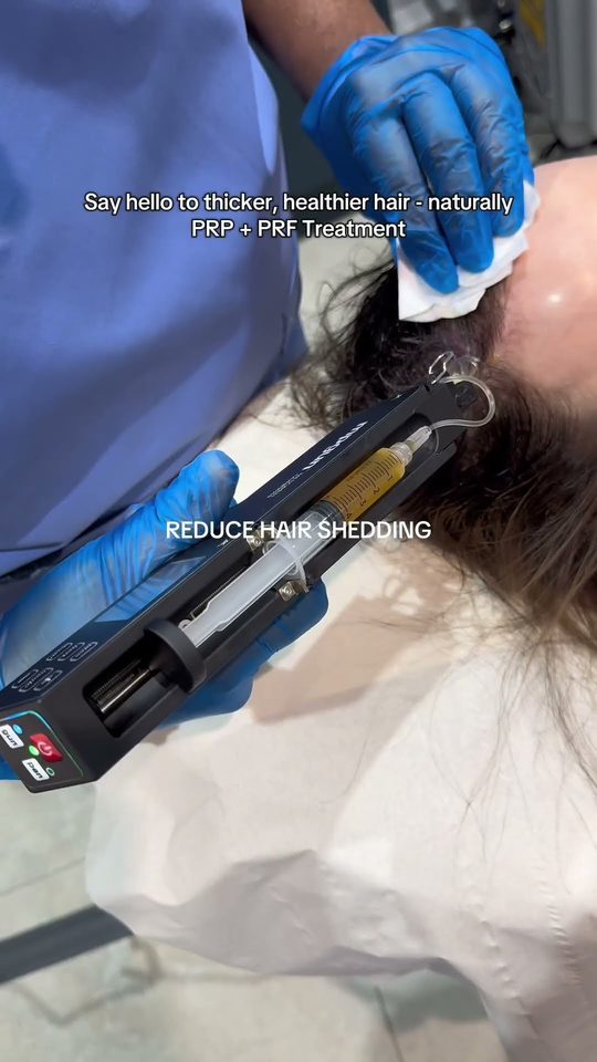 Doctor-led PRP and PRF combination treatment being delivered into the scalp at Rejuvena, Bedford
