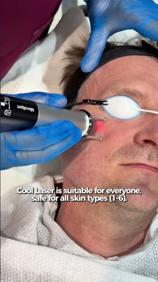 Cool Laser, safe for every skin type