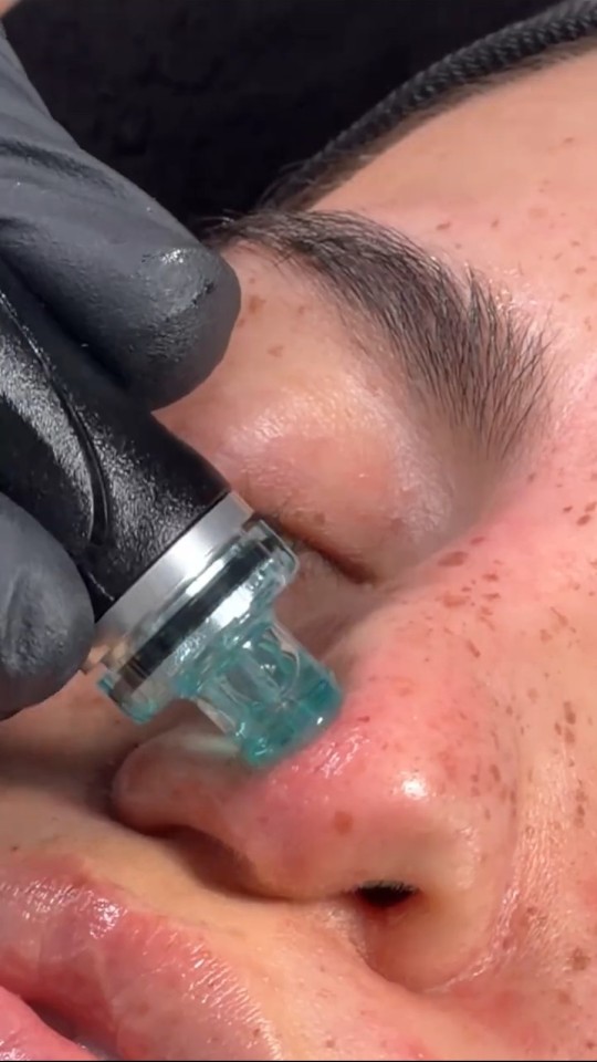 See HydraFacial at Rejuvena Bedford