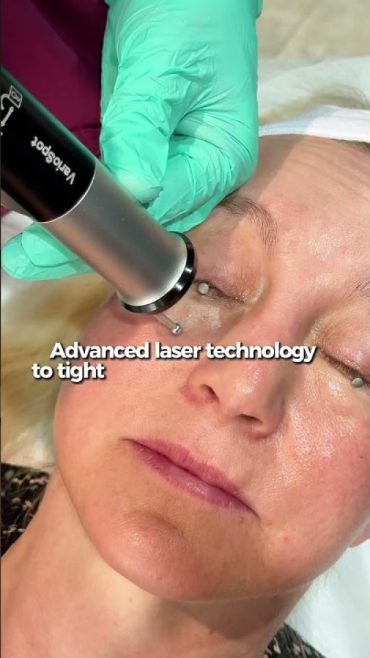 Advanced laser technology to tighten eyelids