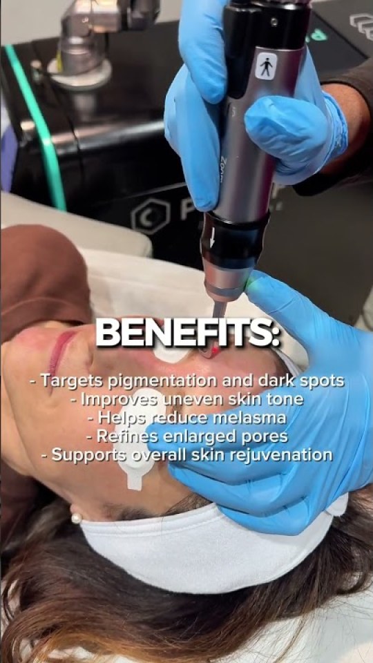 The laser that targets unwanted pigment