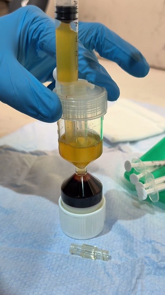See PRP preparation at Rejuvena Bedford
